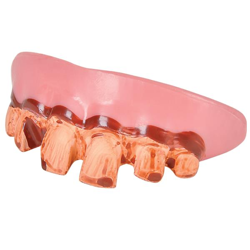 [P05.241] Dientes Picados